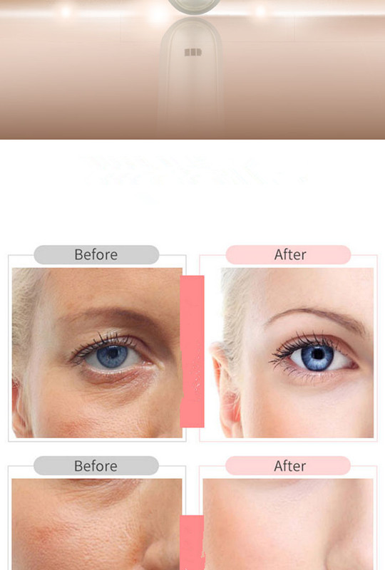 Ultrasonic knife(图7)